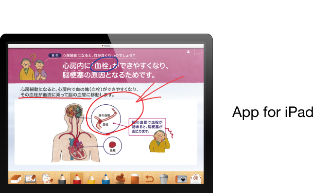 心房細動・脳梗塞サポートアプリ